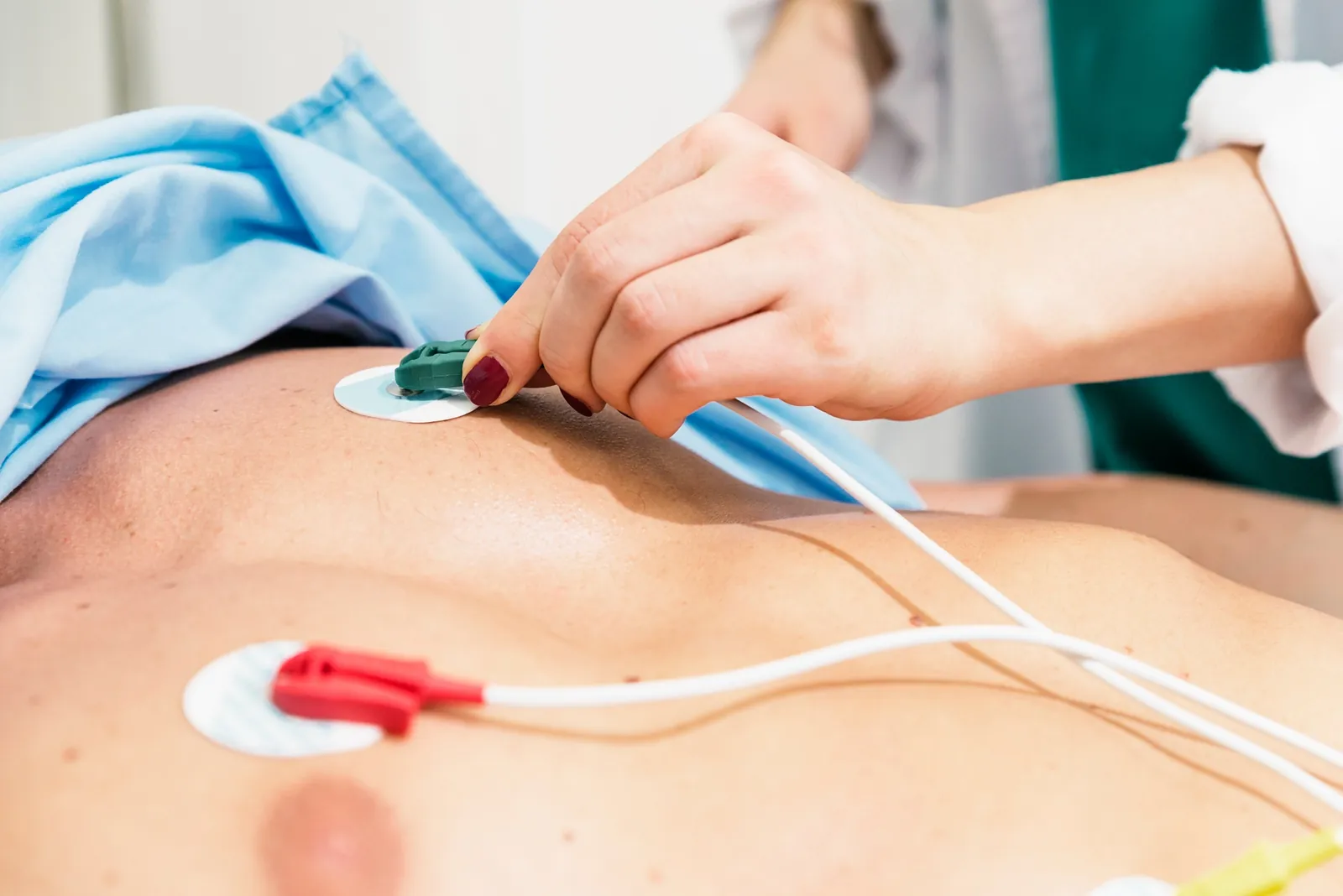 ECG (Elektrokardiogram)
